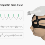 Energy Guided Brain - EMBP