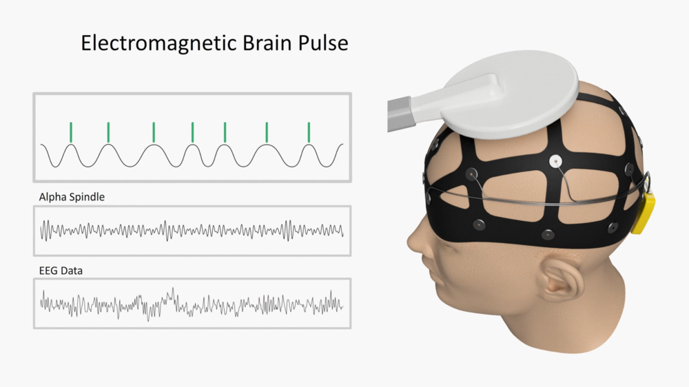 Energy Guided Brain - EMBP